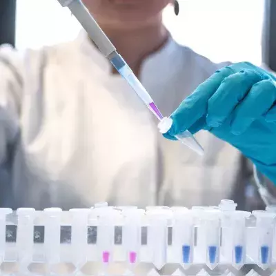 Covid-19 truth about Wuhan virus scientist killed 