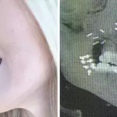 Default image