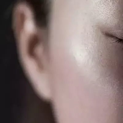 Default image