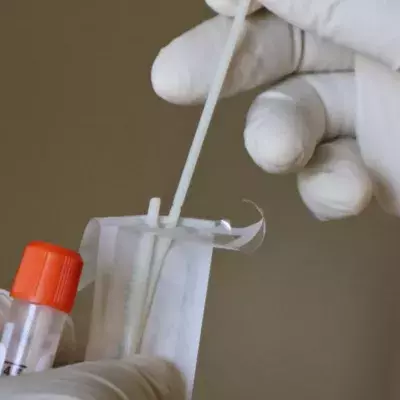 At home HPV smear tests are being offered to Brits 