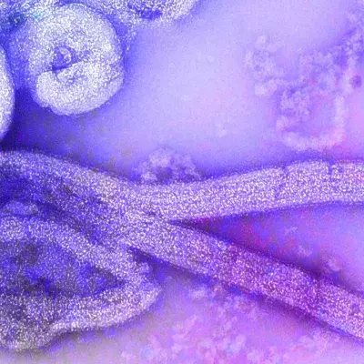 A new outbreak of this deadly infectious disease