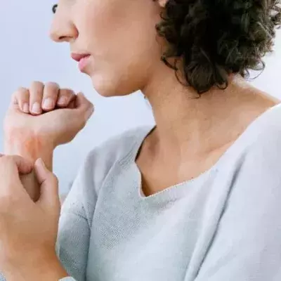 Skin Irritations: The New Symptom of COVID-19 to Monitor Closely