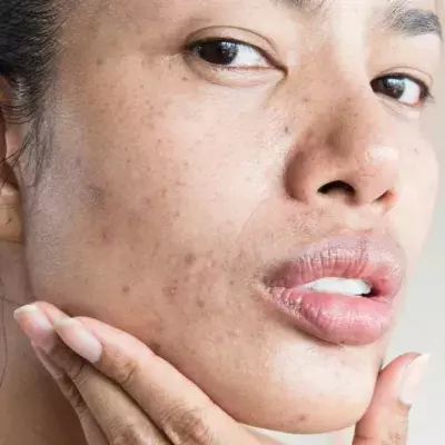 Skin positivity