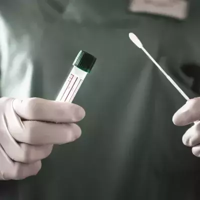 Swab test