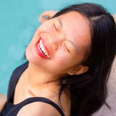 These are five skin positivity influencers you absolutely need to know about 