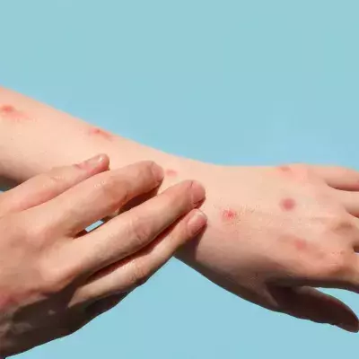 US infected with 1/3 of monkeypox cases worldwide, but the virus isn’t the only thing that’s spreading 