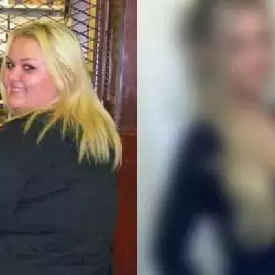 Weight loss