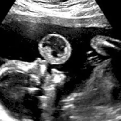 Baby Bubble