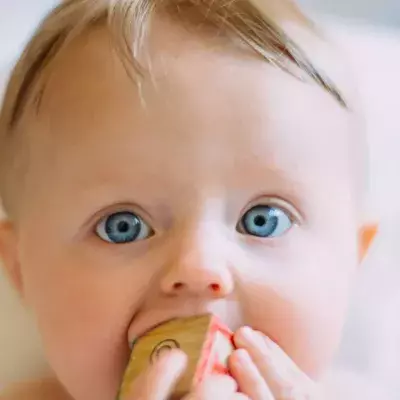 baby's head contained the foetus of its identical twin