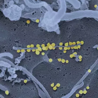 Crimean-Congo Haemorrhagic Fever deadly virus