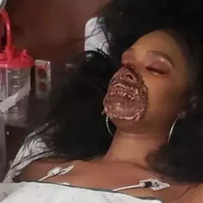 A Dancer In Zombie Makeup Ends Up In Hospital