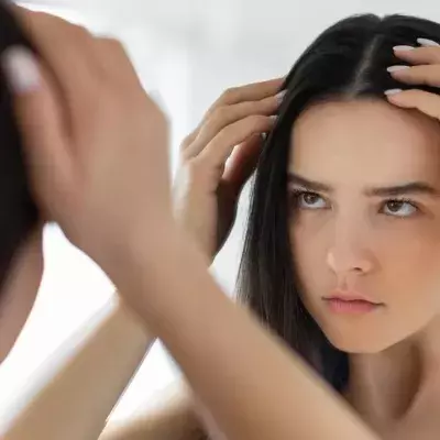 Dandruff unexpected reason it actually happens