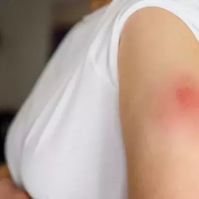 Does Windmilling Your Arm Really Help Vaccine Pain? 