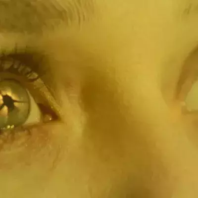 expert reveals happens phenomenon eyes before after death body