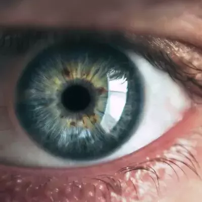 Eye floaters