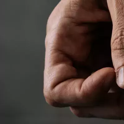 Hangnails: These are the causes and how to prevent them