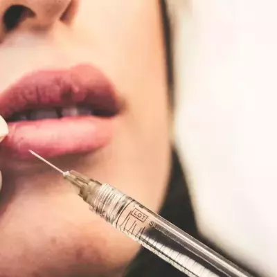 Herpes: Lip fillers can increase your chances of getting cold sores