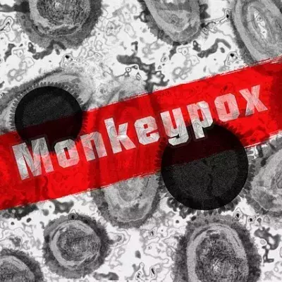 Monkeypox: This unexpected symptom has been revealed by a recent study 