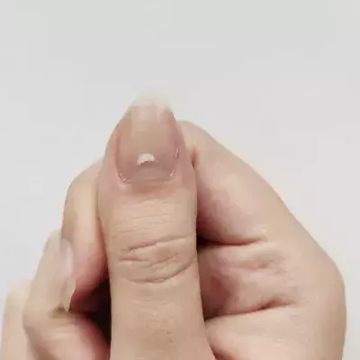 Nail with white mark