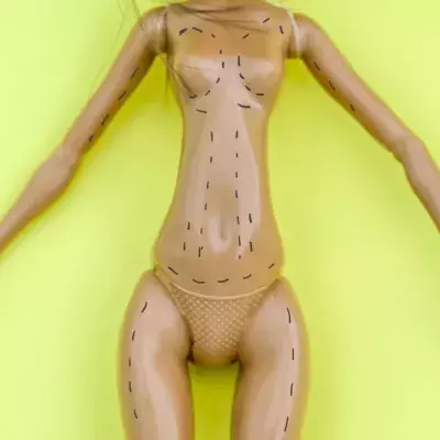 Nipple surgery is the worrisome new trend sweeping America
