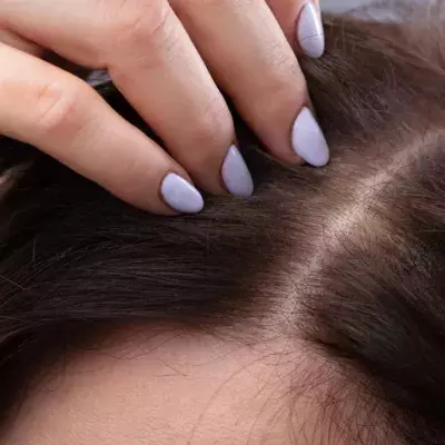 Nit Shampoo Found To Be An Effective Treatment Against COVID-19