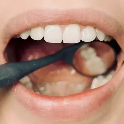 This nut may be a 'major contributor' to mouth cancer