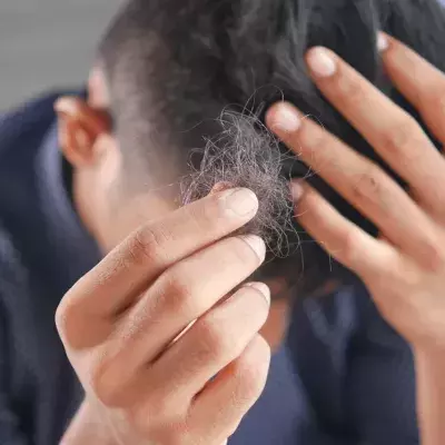 The real reason why men lose their hair more than women