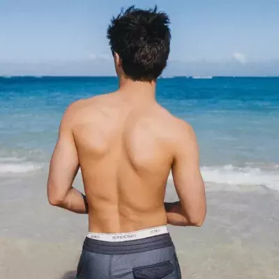 Skin cancer: What will cause the global melanoma rate to rise by 50% and who is at most risk?