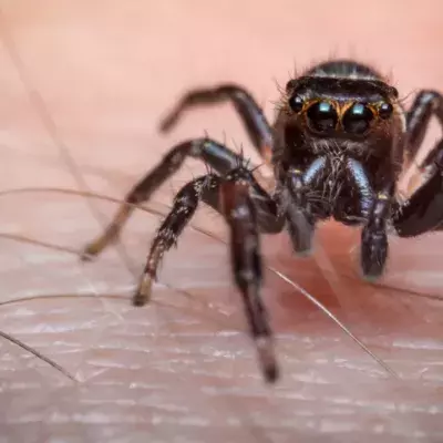 spider bite