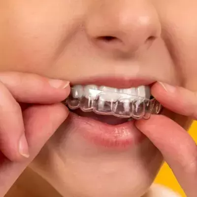Teeth grinding in your sleep - here's why you should see the doctor if you do this