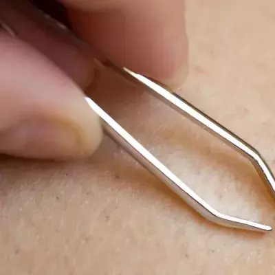 These are the best home remedies for ingrown hairs 