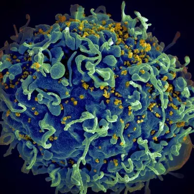 Third patient cured from HIV