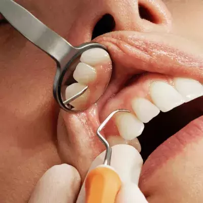 Tiktok dentist claims cavities are contagious - is it true?