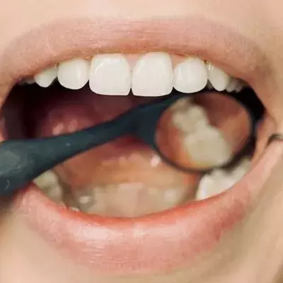 This is what the colour of your teeth says about your oral health