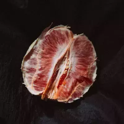 What is vaginal dryness?