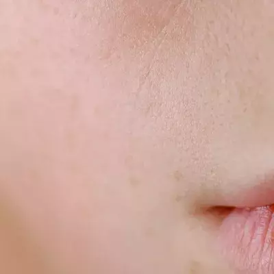 This is what your skin reveals about your health