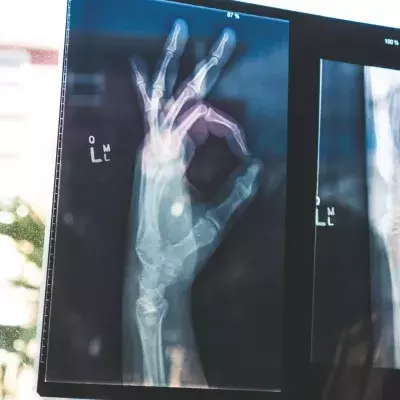 X-Ray