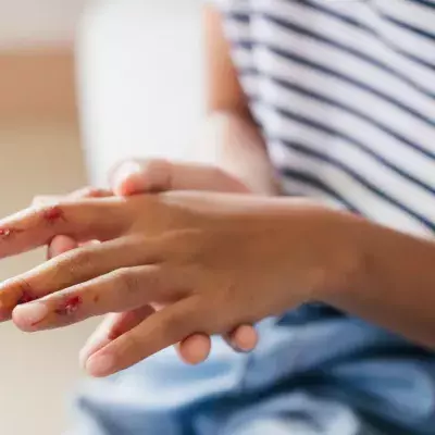 Is your wound Infected or healing? Here’s how to tell the difference