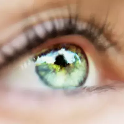 Default image