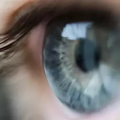 Default image