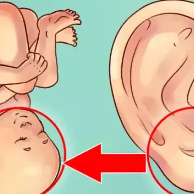 Ear shape