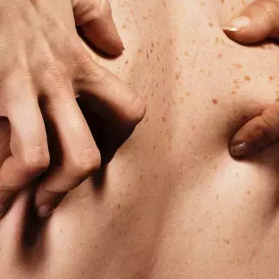 Default image