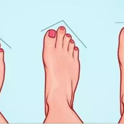 Foot shape