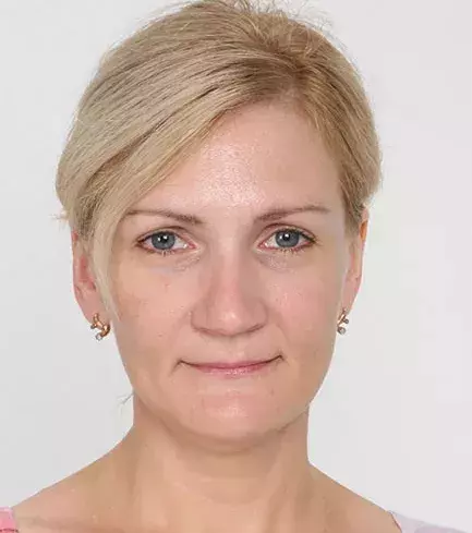 Before: Natalija