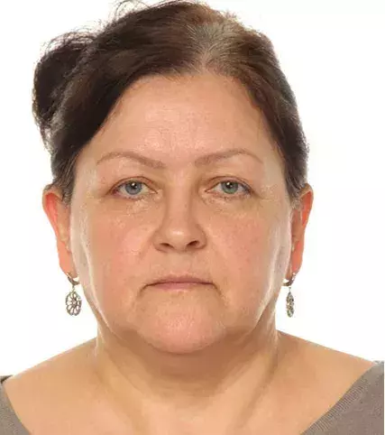 Before: Tatjana
