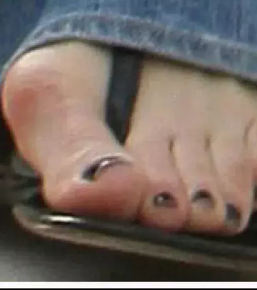 When your big toe curves inward!