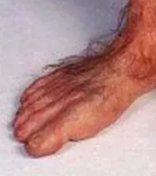 When your feet are just extremely hairy!