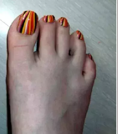 When your pedicure goes wrong!