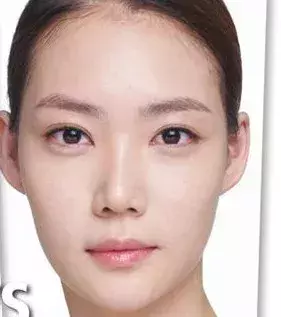 After: The appearance of imperfections is reduced and skin tone is evened out. But it is not suitable for oily skin types.