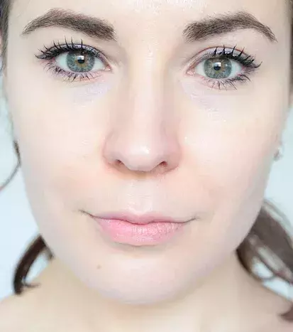 After: The result is a smooth and even-toned complexion with a softer appearance.